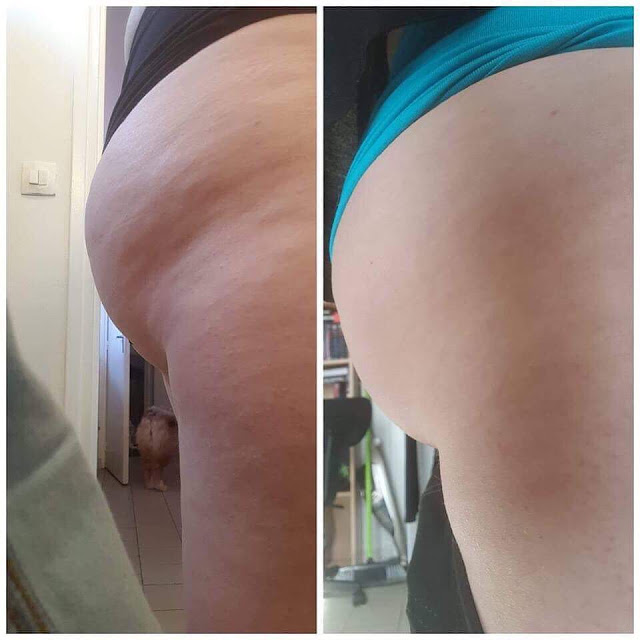 Le régime alimentaire pour lutter contre la cellulite en 15 jours