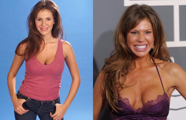 Nikki Cox Surgery.