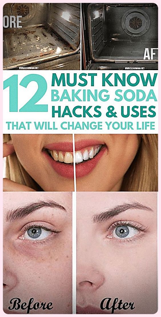 Every Woman Should Know These 15 Baking Soda Tricks medicine health life
