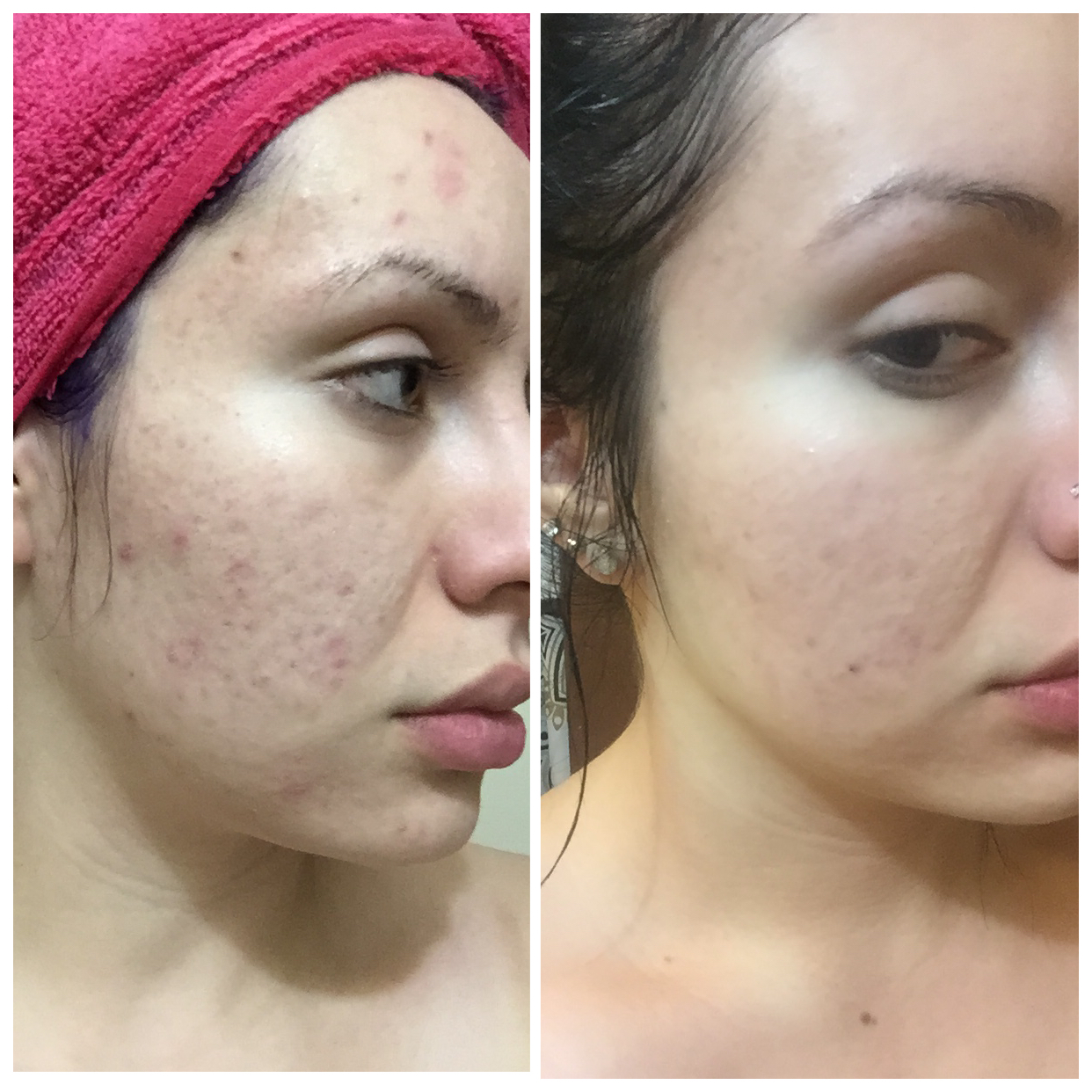 Makeup Artist's Choice Before/After Pics and Testimonials