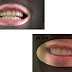 Amos Dudley "The Student who designed and 3D prints his own braces"