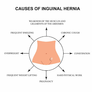cause of hernia