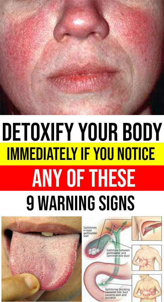Detoxify Your Body Immediately If You Notice Any Of These 9 Warning Signs