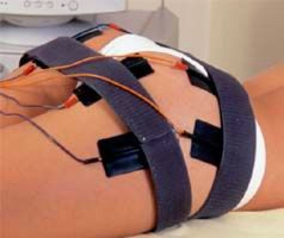 Corrente russa para tonificação muscular, é excelente no combate a flacidez! Dicas Bem Viver Corrente russa para tonificação muscular, é excelente no combate a flacidez! Dicas Bem Viver