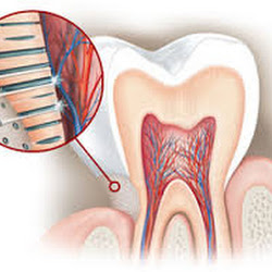 froid aux dents froid aux dents