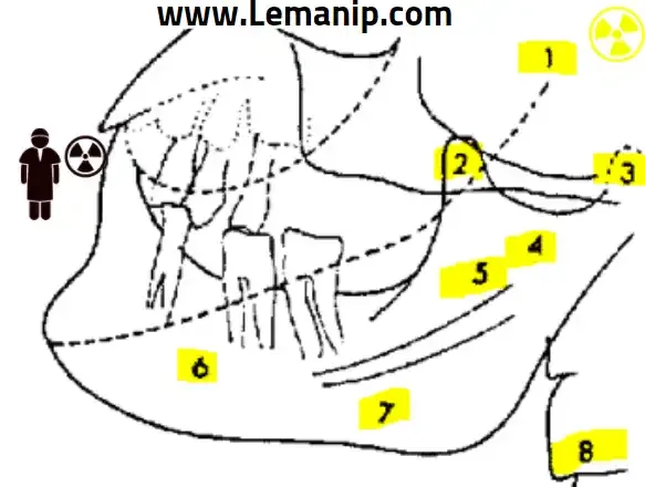 Anatomie radiologiaque maxilaire defilee