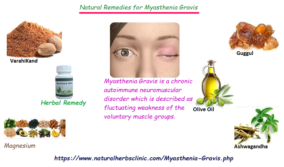 Natural Herbal Remedies for Myasthenia Gravis Treat Muscle Weakness