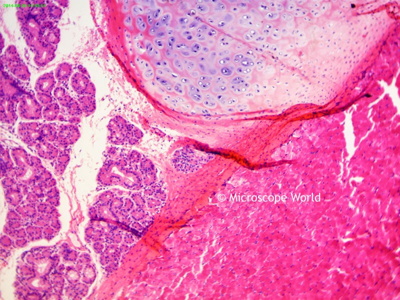 Larynx under the microscope.