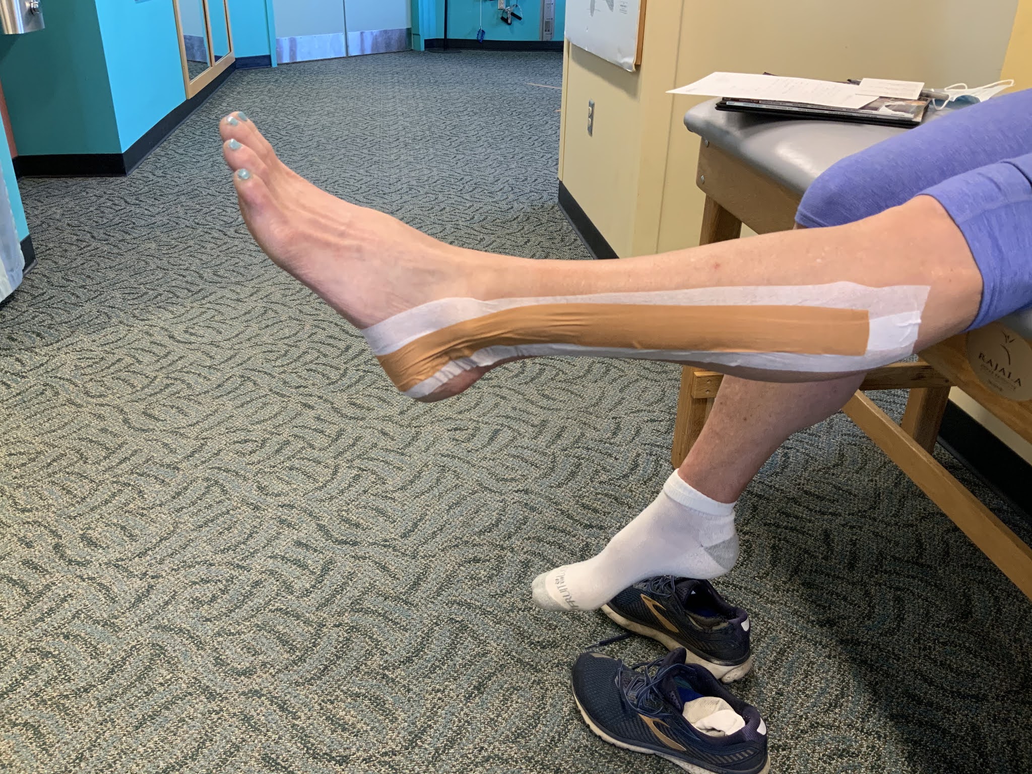 Peroneal Tendonitis Taping