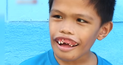 Re: [新聞] 5歲男童長滿「300顆牙齒」超密集照片曝