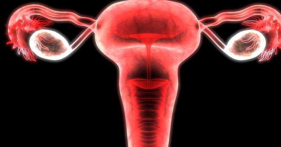 Do uterine polyps and cervical polyps affect pregnancy? Easy Heal