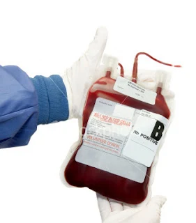 El vitiligo se trasmite por transfusión de sangre