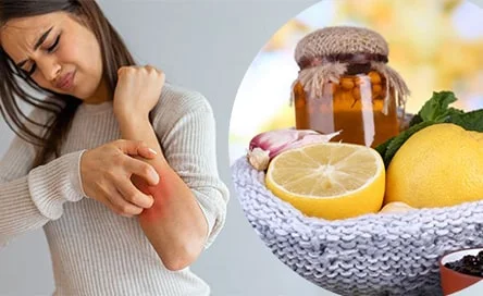 Home Remedies For Itchy Skin: Relieve Itchy Skin
