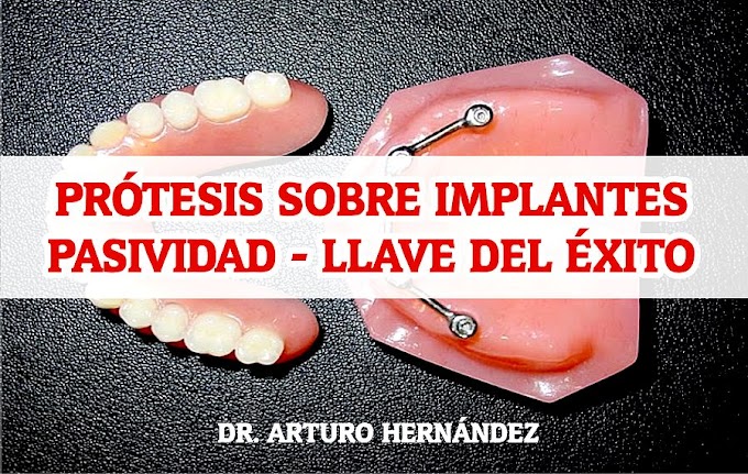 WEBINAR: PRÓTESIS SOBRE IMPLANTES - Pasividad, llave del éxito - Dr. Arturo Hernández