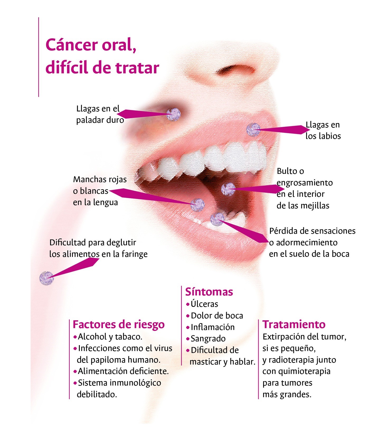 sintomas-cancer-oral