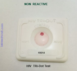 hiv test me non reactive means in hindi