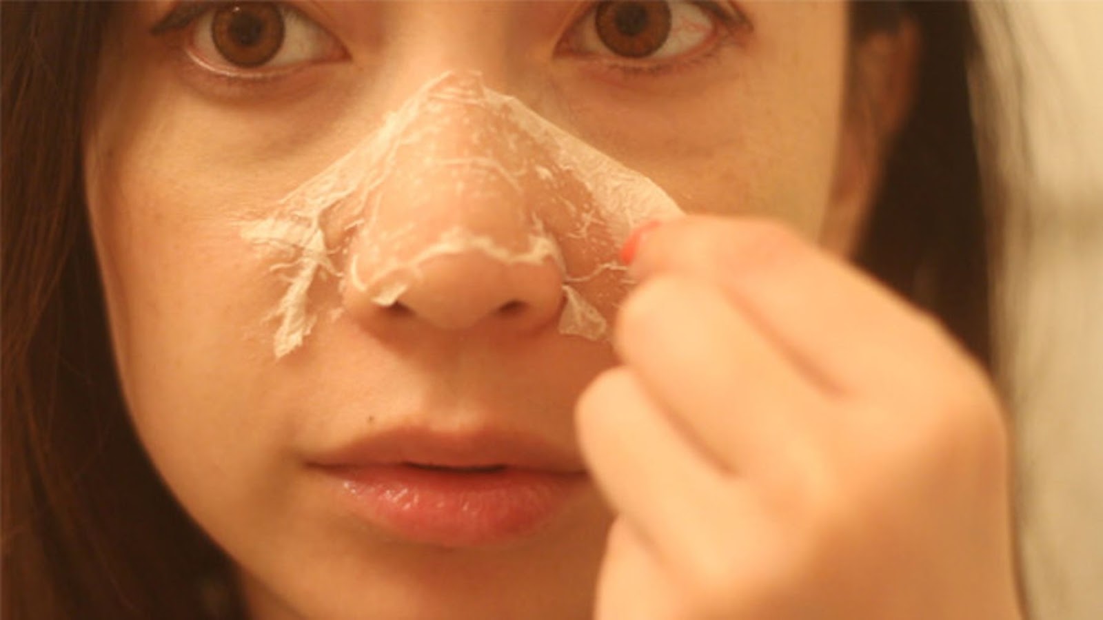 Home remedies to remove black heads