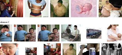 photo gambar anak gemuk obesitas kelebihan berat badan