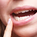 Quy trình nhổ răng khôn tại nha khoa