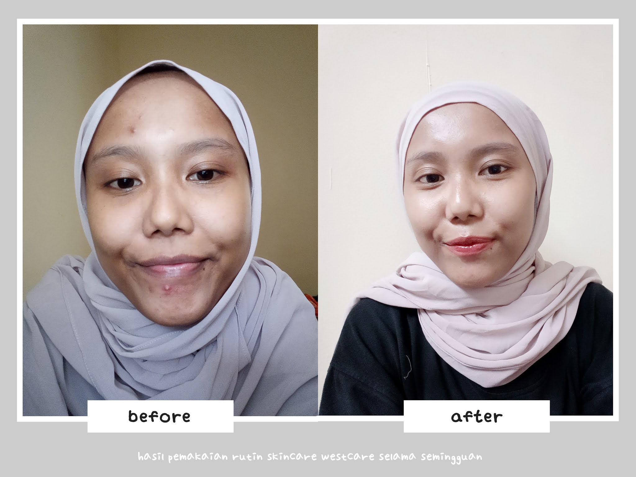 hasil pemakaian westcare selama seminggu
