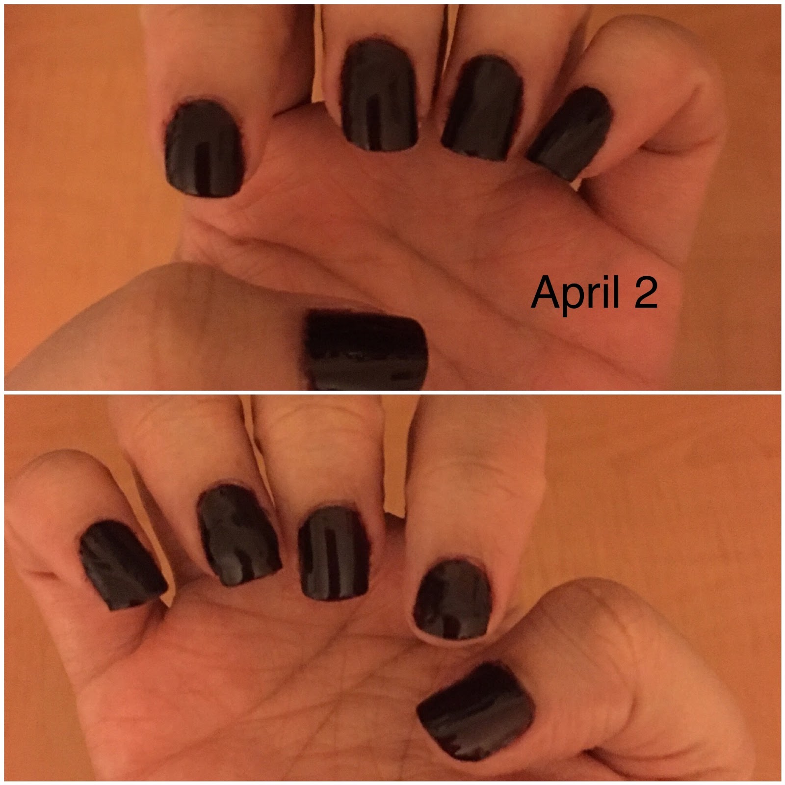 How to Save and Regrow Nails After a Break