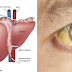 Early Signs and Symptoms of Liver Damage You Should Know About