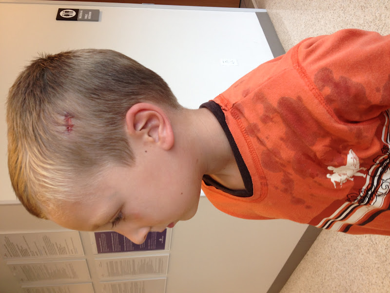 Courtright Family Strep, Stitches, Staples, and Splinters