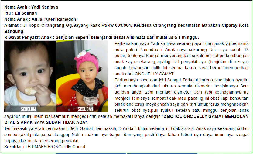 Obat Benjolan Di Sekitar Kemaluan Wanita ini TERBUKTI AMPUH Menyembuhkan Benjolan Di Sekitar Kemaluan Obat Benjolan Di Sekitar Kemaluan Wanita ini TERBUKTI AMPUH Menyembuhkan Benjolan Di Sekitar Kemaluan