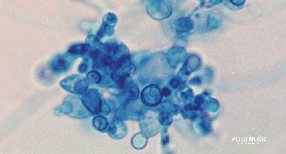 ГРИБКОВЫЕ ИНФЕКЦИИ КАНДИДА (CANDIDA). ПИЩЕВАЯ ТЕРАПИЯ ПРИ КАНДИДОЗНЫХ ИНФЕКЦИЯХ.