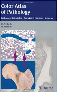Color Atlas of Pathology Pathologic Principles, Associated Diseases, Sequelae