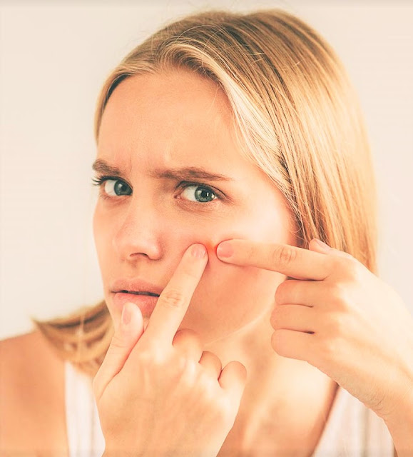 girls pimple girls pimple
