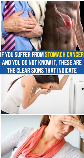 If you suffer from stomach cancer and you do not know it, these are the clear signs that indicate