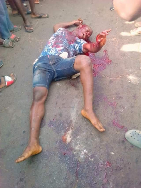  Photos: Divine Justice? Thief falls, hit head on the ground cracking his skull shortly after robbing a lady