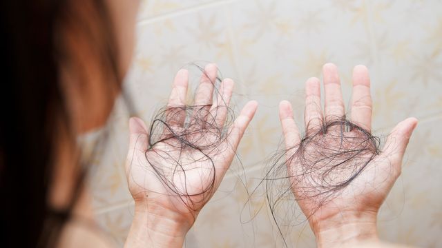Penyakit Yang Menyebabkan Rambut Rontok dan Sakit Kepala Penyakit Yang Menyebabkan Rambut Rontok dan Sakit Kepala