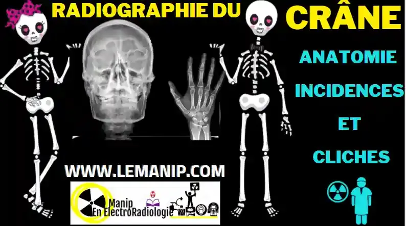 Radiographie du Crâne "Anatomie -Insidences et cliches"