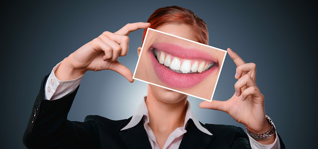 smile makeover woman smiling holding a picture of white teeth