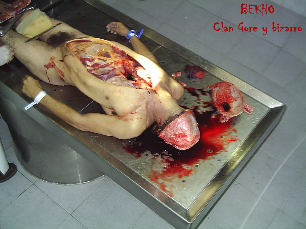 Autopsie of a Man.