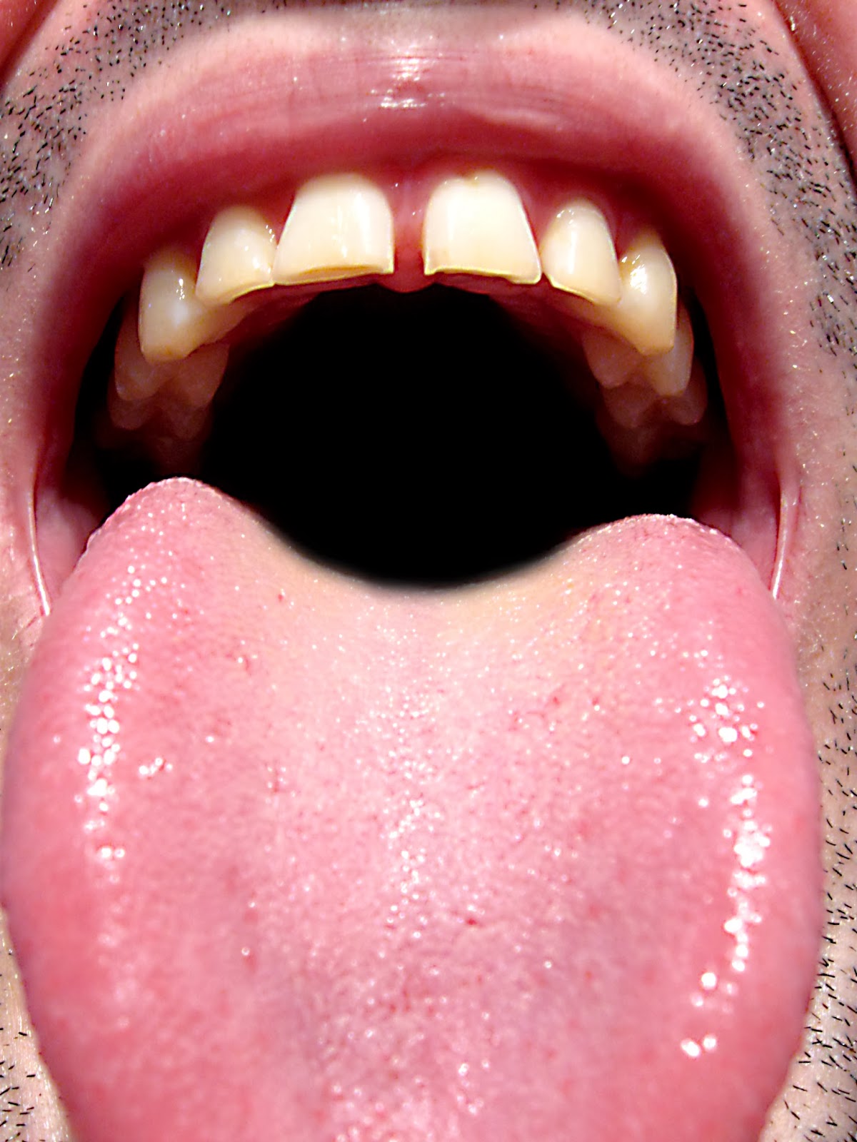 Hasta el borde: Sacar la lengua