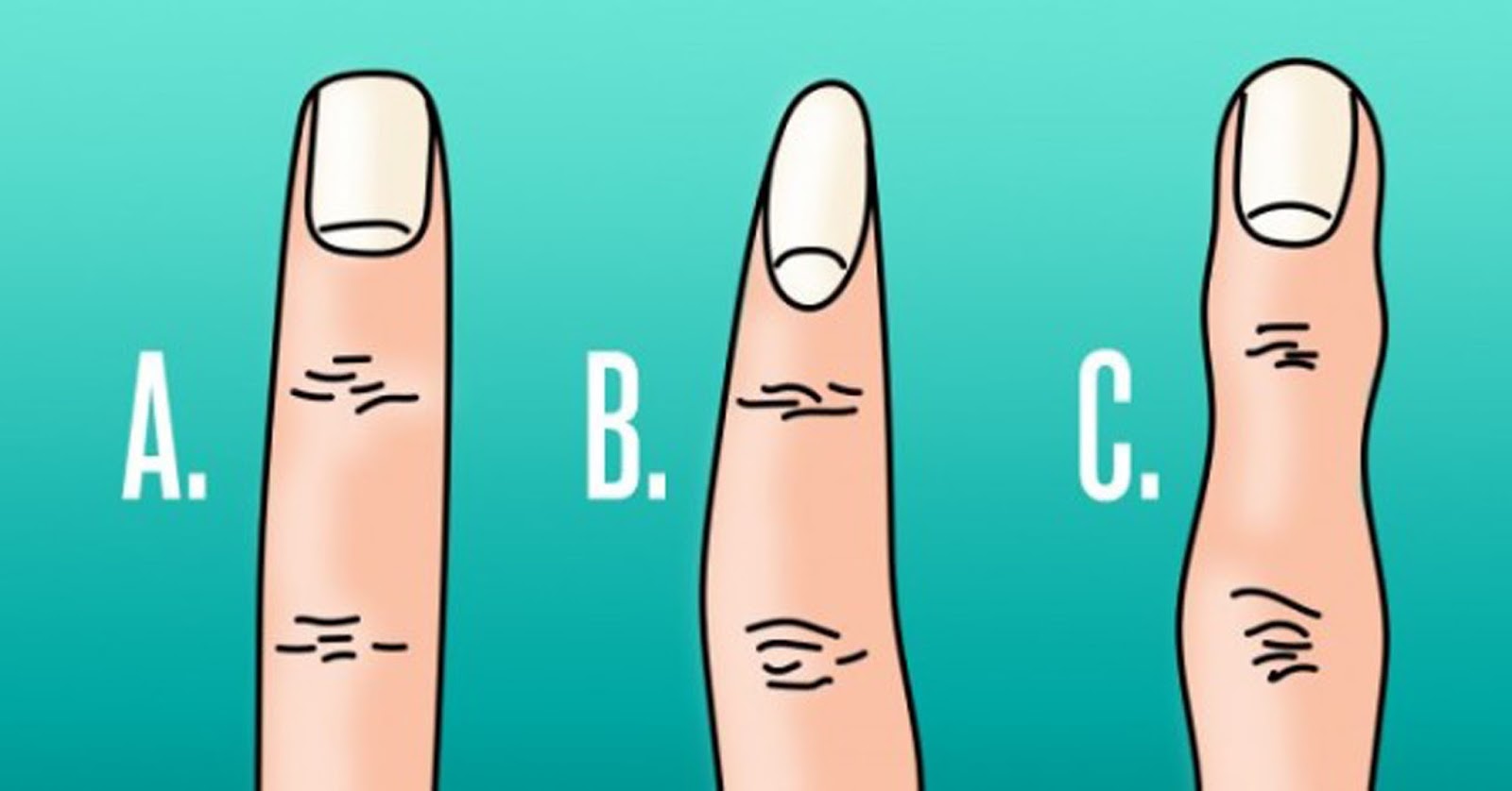 Сколько лет пальцами. Квадратная форма пальцев. Форма пальцев на руках. Коническая форма пальцев. Типы кончиков пальцев.