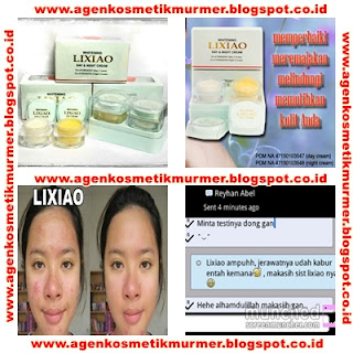 Paket Lixiao Cream asli/murah/original/supplier kosmetik