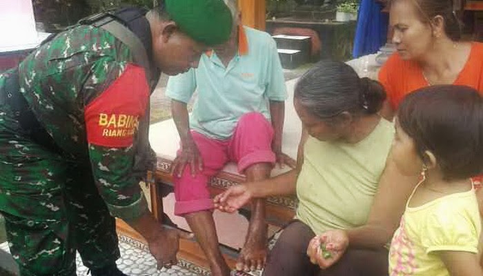 Tabung LPG Bocor, 3 Warga Tabanan Terbakar