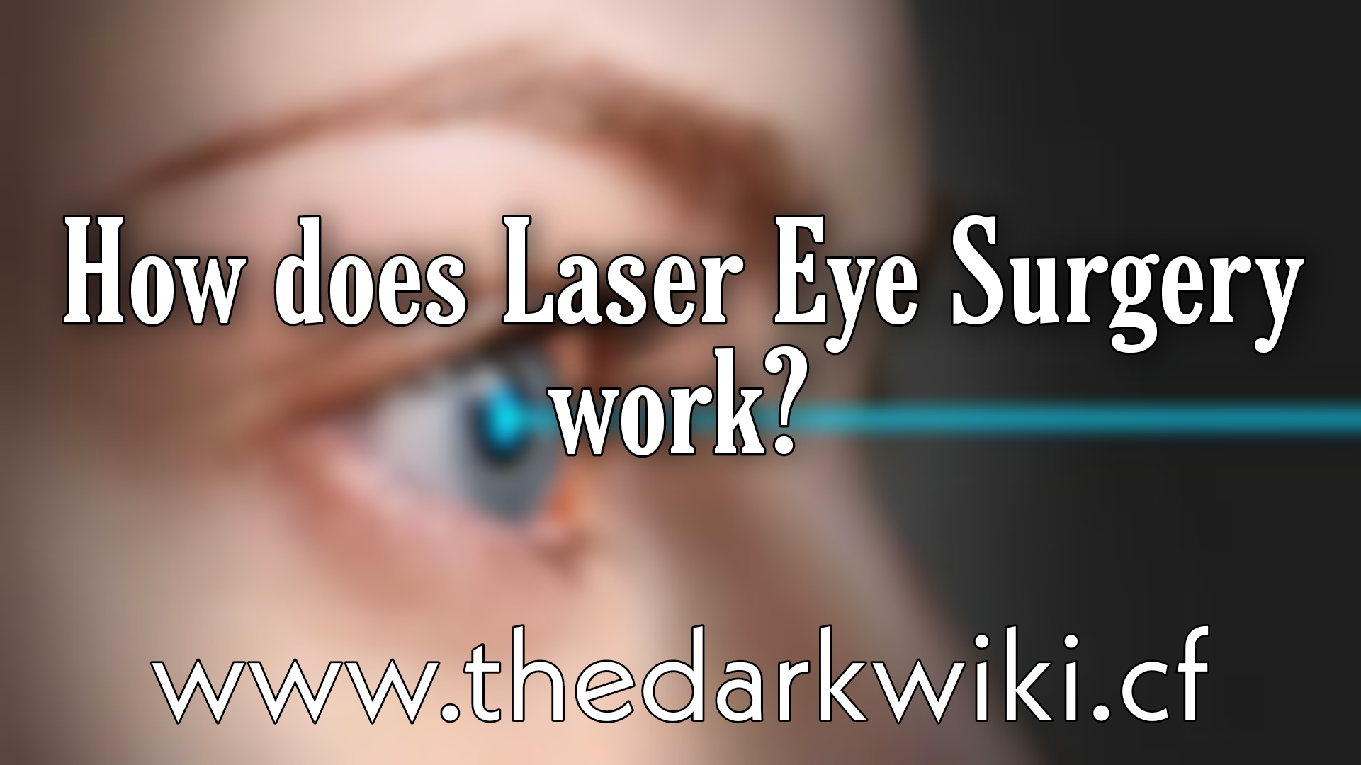 How does Laser Eye Surgery work? The DarkWiki