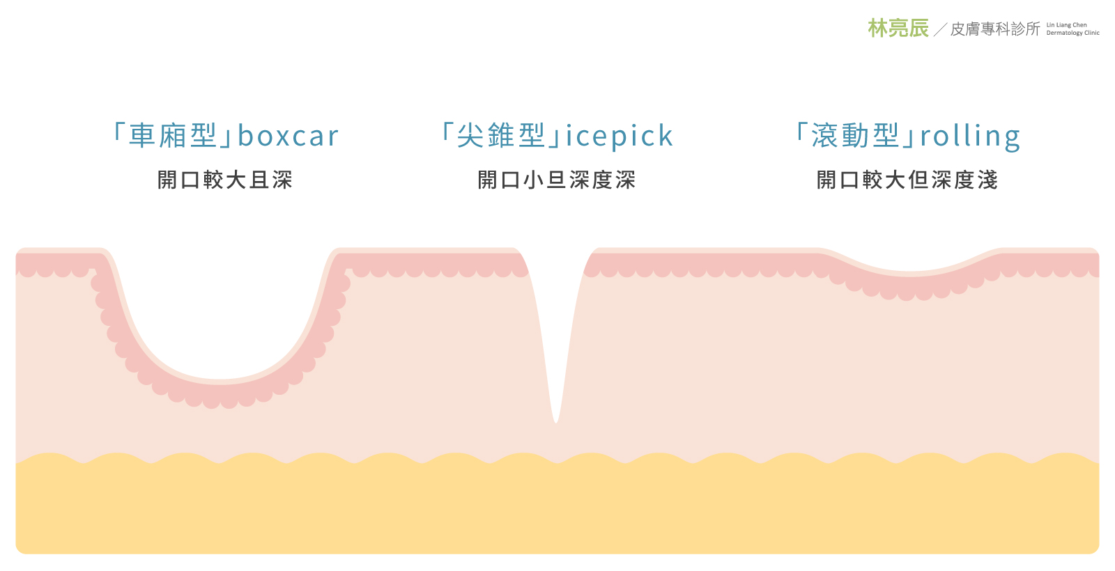 03-紅色痘疤怎麼消?擦藥、雷射、還是不管它? 新竹彩衝光M22彩衝光紅色痘疤ptt紅痘疤多久藥膏雷射消不掉紅痘疤dcard黑痘疤林亮辰皮膚專科診所
