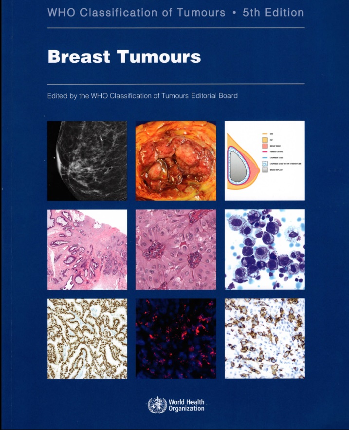 Breast Tumours: WHO Classification of Tumours  5th Edition
