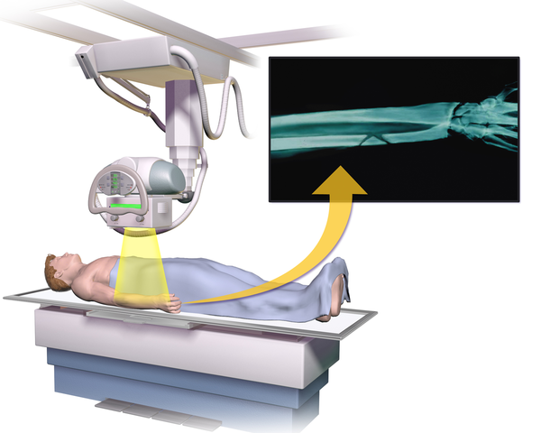 التطبيقات الطبية للأشعة السينية used x-ray