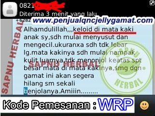 Cara Cepat Menghilangkan Keloid Di Wajah Secara Alami Cara Cepat Menghilangkan Keloid Di Wajah Secara Alami