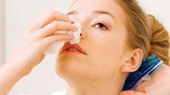 La epistaxis ¿un signo de alarma?