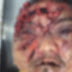 Homem fica com rosto desfigurado e é assassinado a pauladas em Parintins