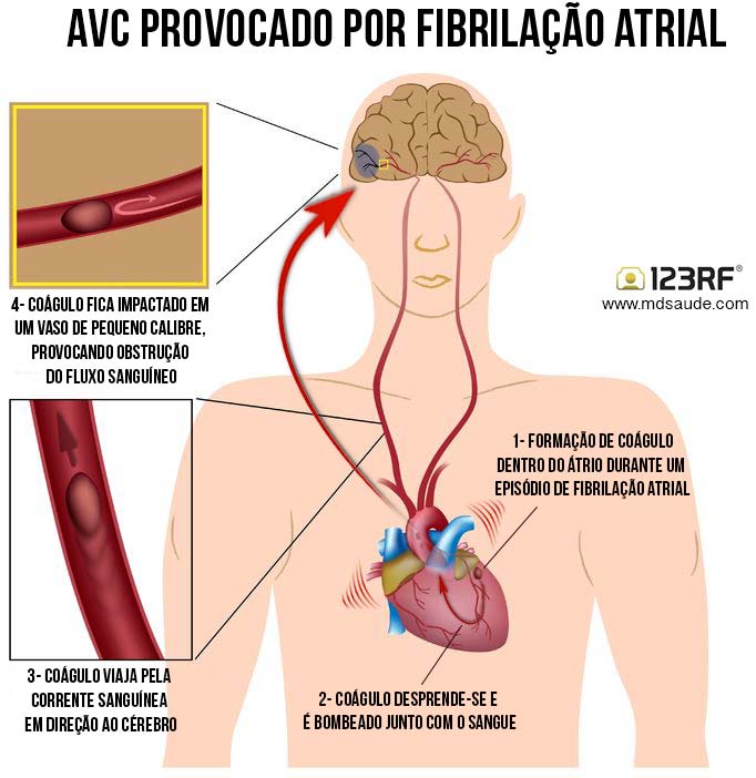 Pou Banco de Imagens para seus Projetos Criativos - 123RF