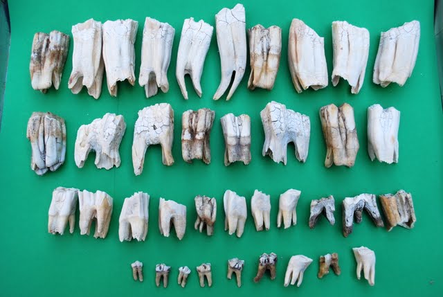 Bittersweet Bric-a-Brac: A Collection of Teeth???